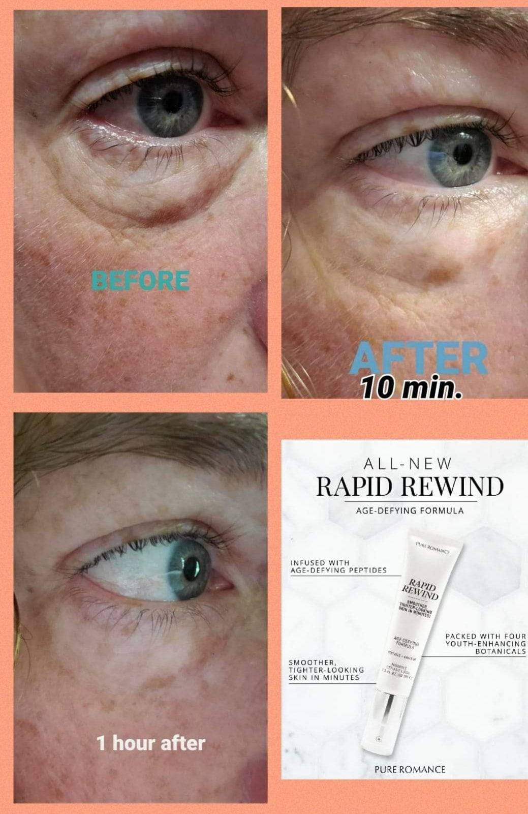 Rapid Rewind Undereye bags be gone