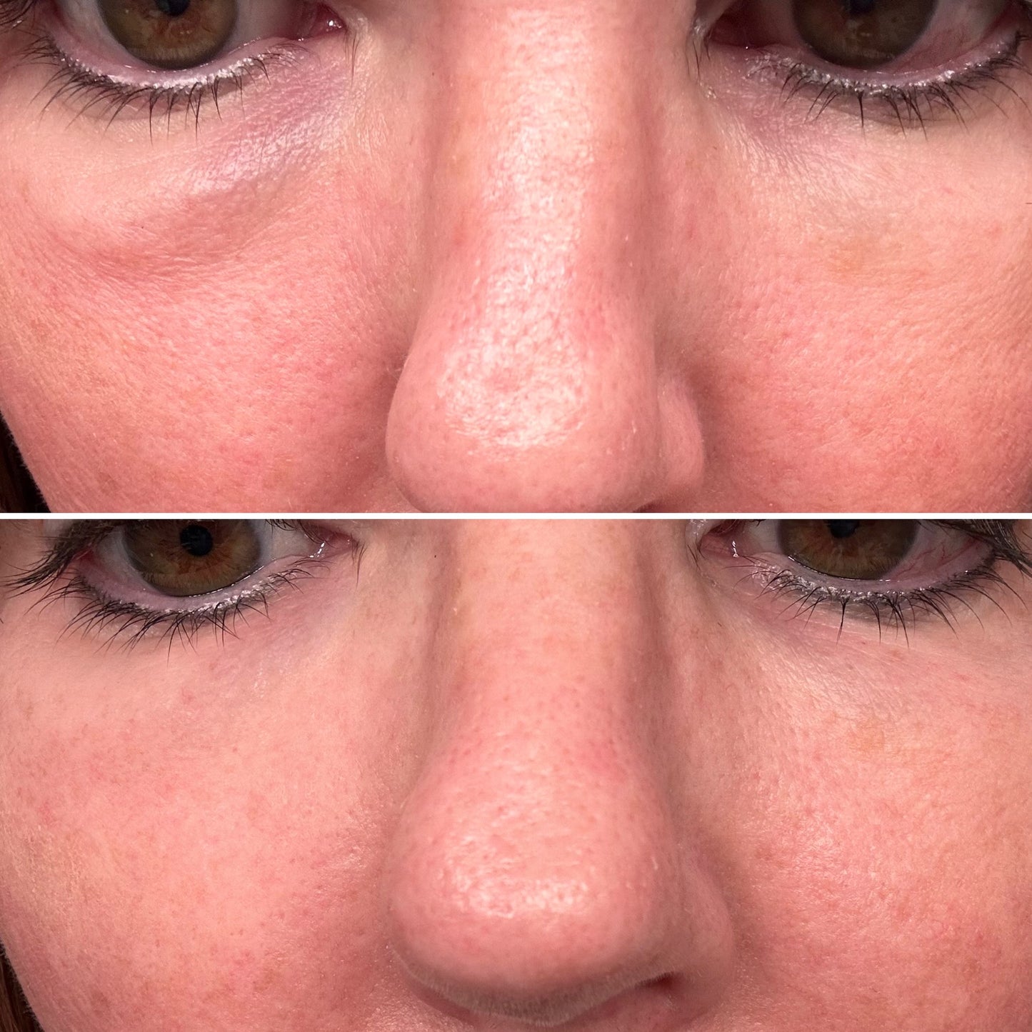 Rapid Rewind Undereye bags be gone